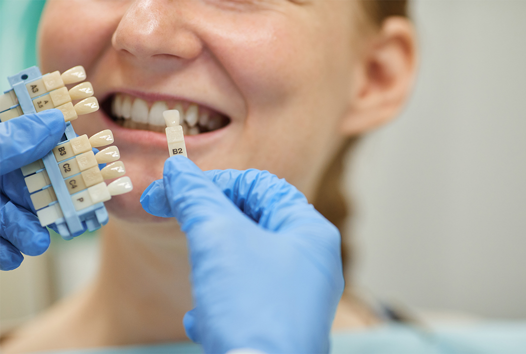 Dental Veneer Campaign