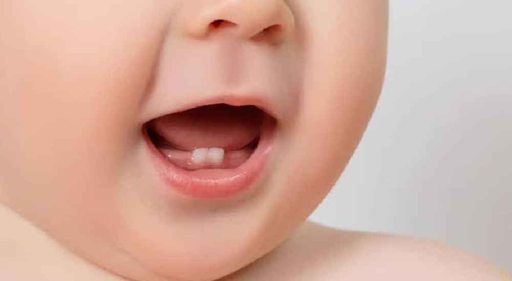 Çocuğumun dişleri sallanıyor, alttan daimi dişi geliyor?