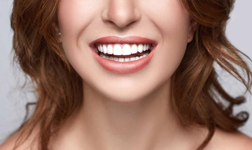 Hollywood Smile-Paket